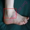 ankle (Oops! image not found)